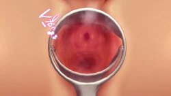 Page 78 of Omega on the shore